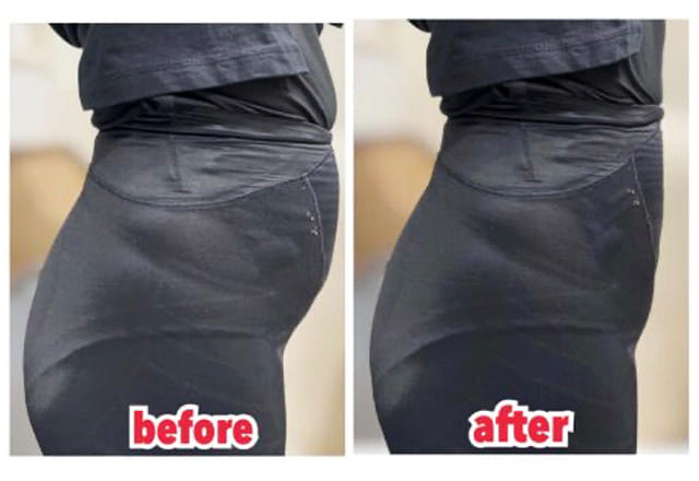 before after